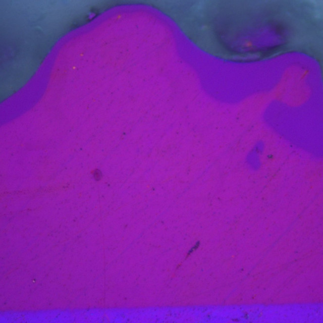 Metallgraphisches Schliffbild durch „Pickel“ – Vergrößerung: 1000:1